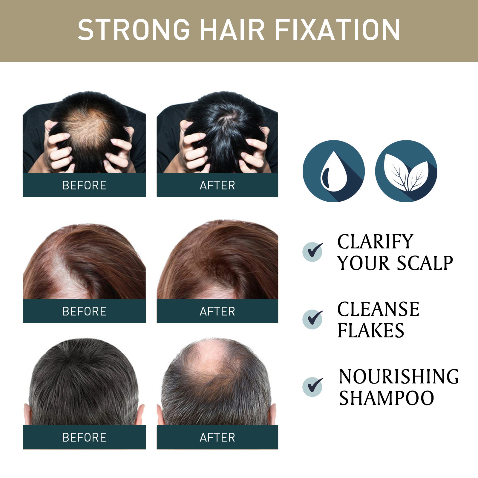 2pcsx100ml 모발 성장 샴푸 고대 아프리카 모발 - Hair Care Natural Ingredients 리뷰 및 가격
