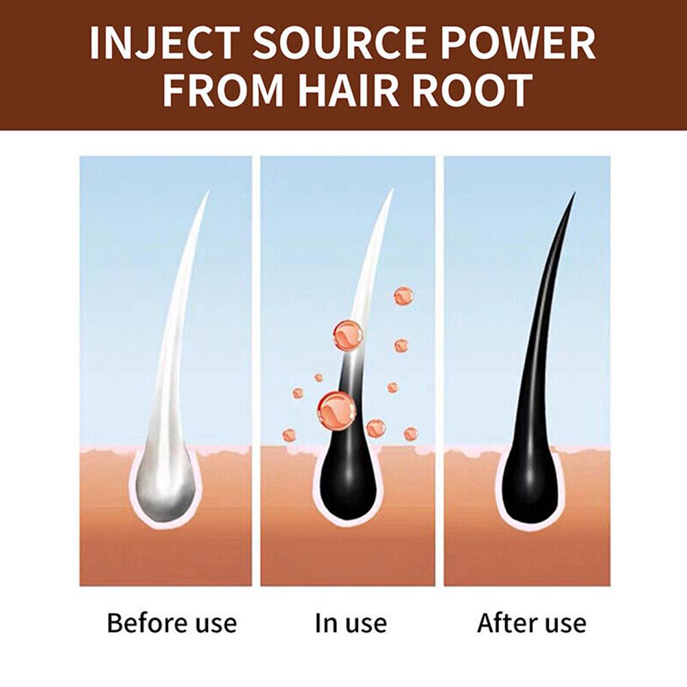 천연 폴리곤럼 수제 비누 딥 클렌징 강화 영양 샴푸 비 - Hair Care Dandruff 리뷰 및 가격